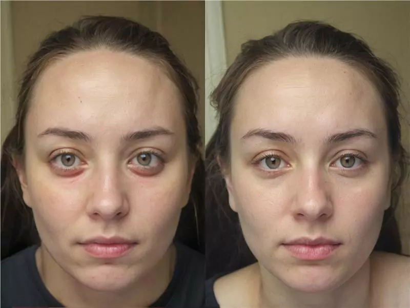 DeepSleep Bliss Review 1